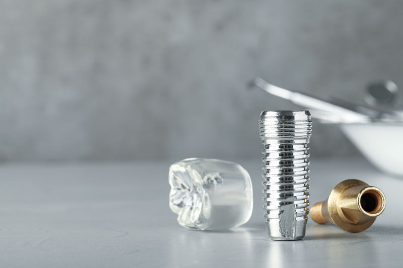 Dental implant pieces laying on a on a table, close up image of dental implant model. Reflecting off of the gloss table it shows all parts of a dental implants.